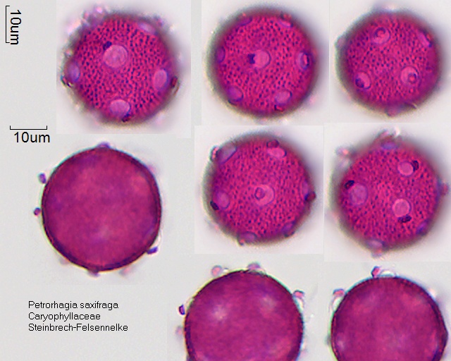 Pollen von Petrorhagia saxifraga