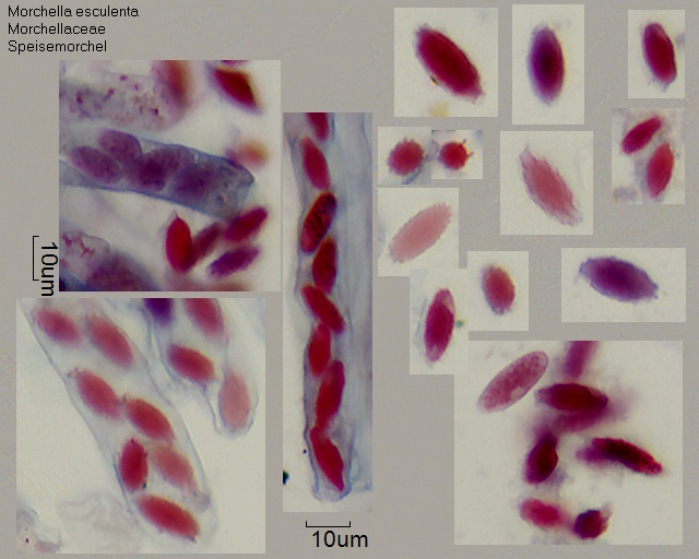 Sporen von Morchella esculenta