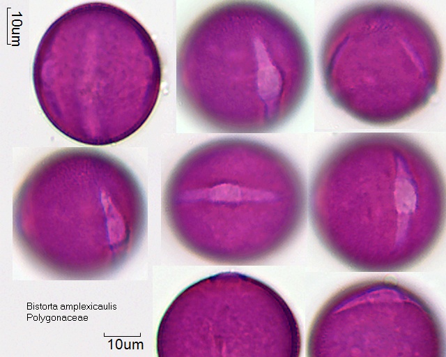 Pollen von Bistorta amplexicaulis, 4-003-1, Durchmesser ca. 37 μm