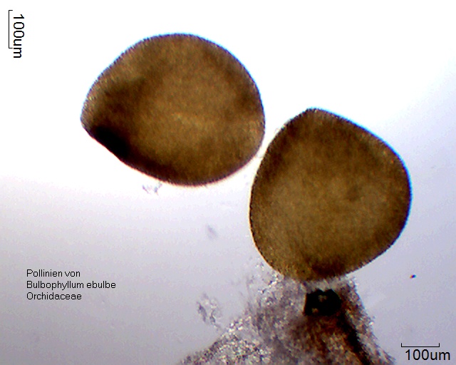 Datei:Pollinium von Bulbophyllum ebulbe.jpg