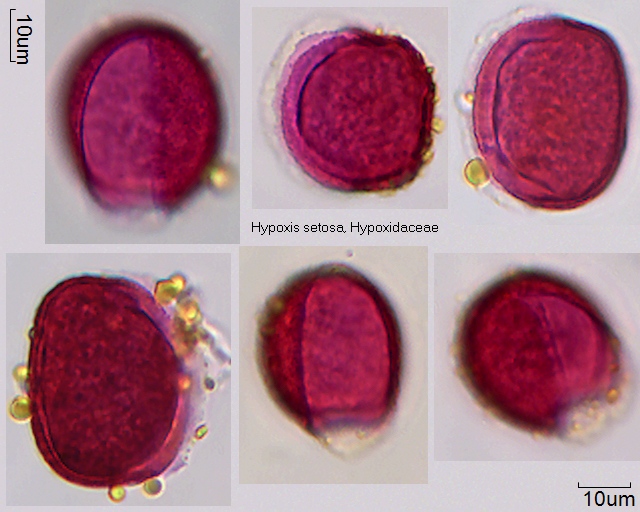 Pollen von Hypoxis setosa