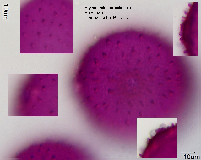 Pollen von Erythrochiton brasiliensis