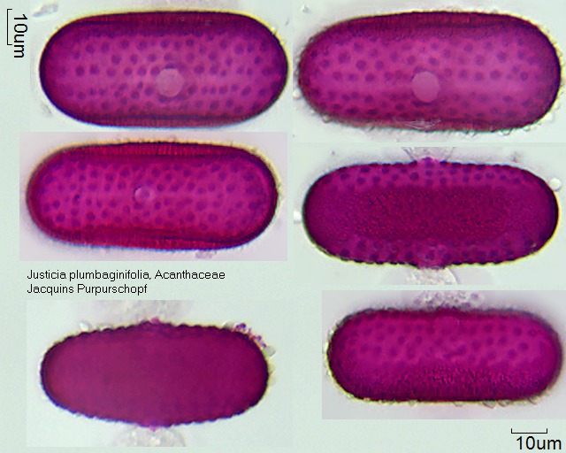 Pollen von Justicia plumbaginifolia