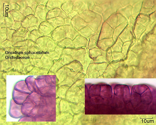 Pollen aus dem Pollinium von Oncidium sphacelatum