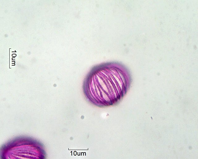 Pollen von Spathiphyllum wallisii