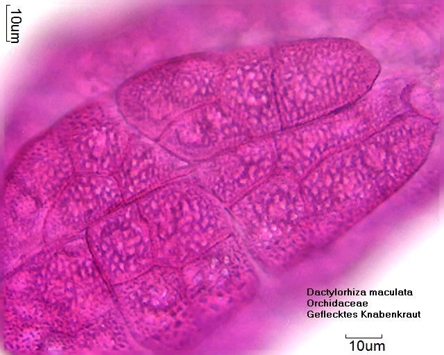 Datei:Dactylorhiza maculata (2).jpg
