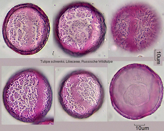 Pollen von Tulipa schrenkii, 6-081]]