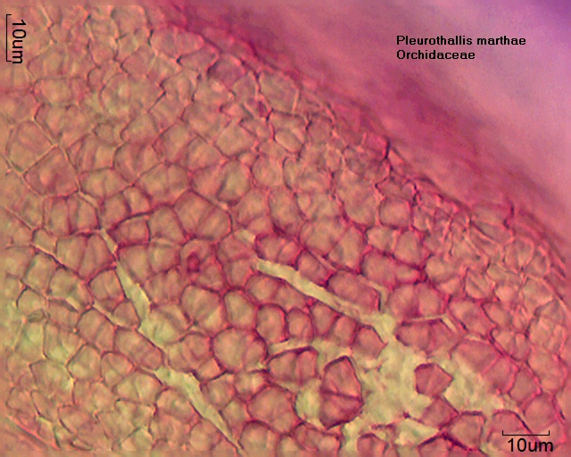Zellen des Polliniums von Pleurothallis marthae