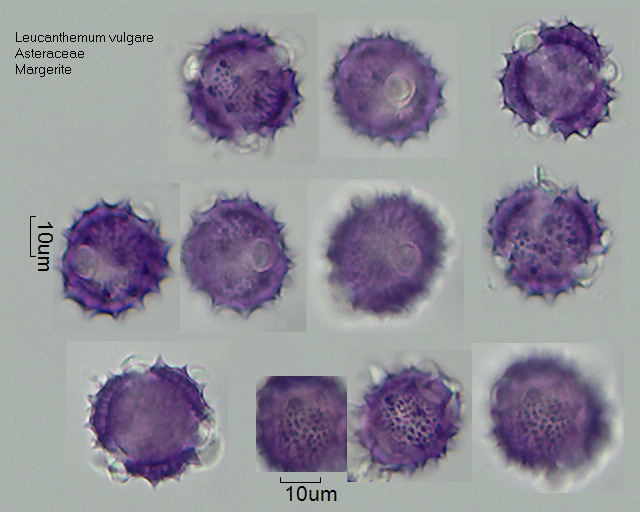 Pollen von Leucanthemum vulgare
