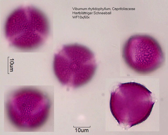 Datei:Viburnum rhytidophyllum (3).jpg