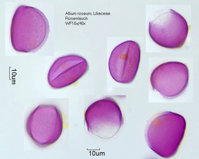 Pollen von Allium roseum, 3-098