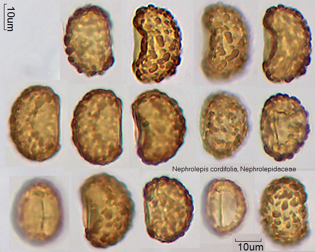 Sporen von Nephrolepis cordifolia