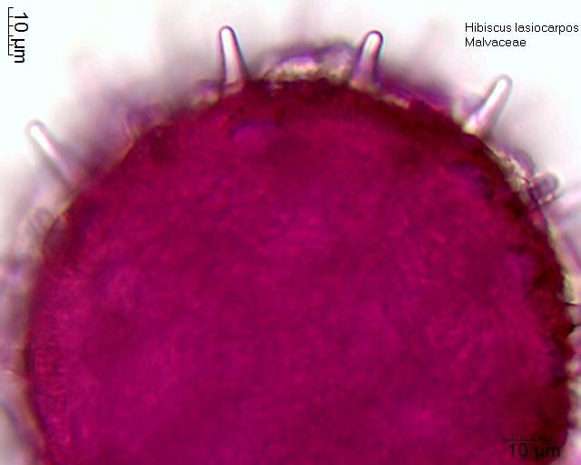 Pollen von Hibiscus lasiocarpos