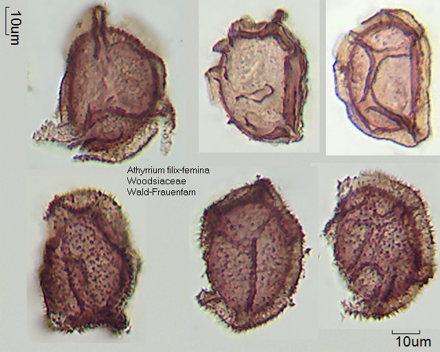 Sporen von Athyrium filix-femina