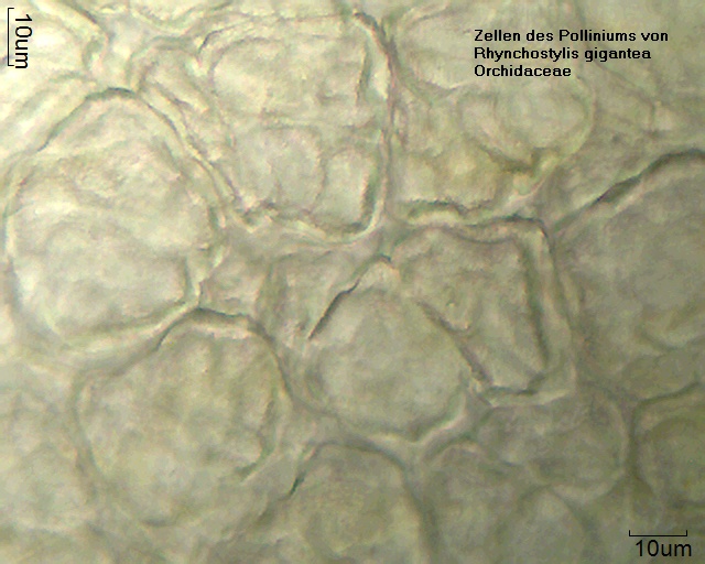 Zellen aus dem Pollinium von Rhynchostylis gigantea