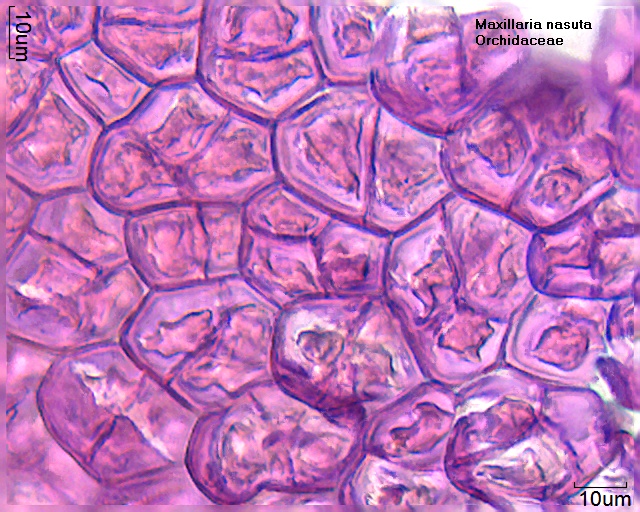 Pollen im Polliniun von Maxillaria nasuta, gefärbt mit Fuchsin, in Glyceringelatine eingebettet