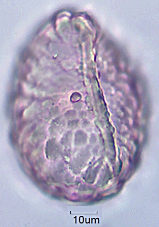 Datei:Polypodium vulgare monolet (2).jpg