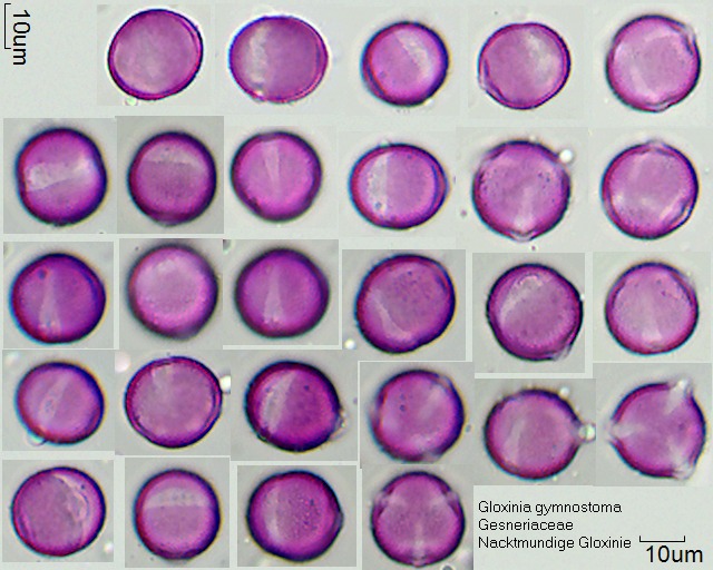 Pollen von Gloxinia gymnostoma