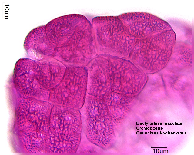 Pollen von Dactylorhiza maculata