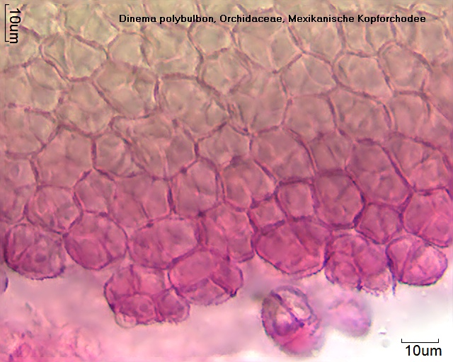 Pollen von Dinema polybulbon