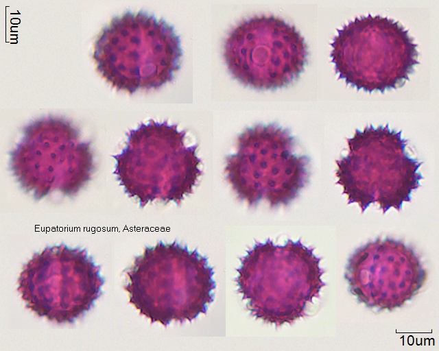 Pollen von Eupatorium rugosum