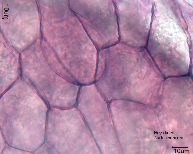Zellen aus den Pollinien von Hoya kerrii