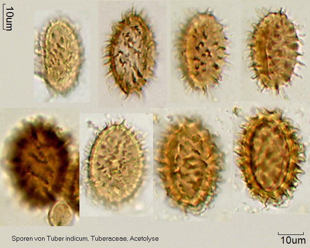 Acetolysierter Sporen von Tuber indicum
