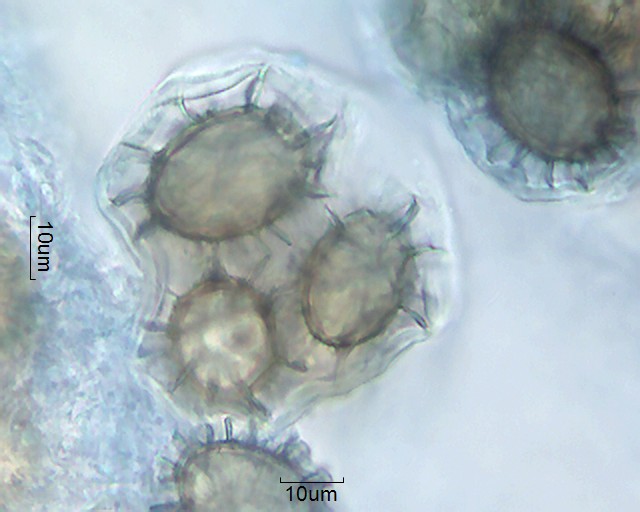 Tuber aestivum \u2013 Pollen-Wiki