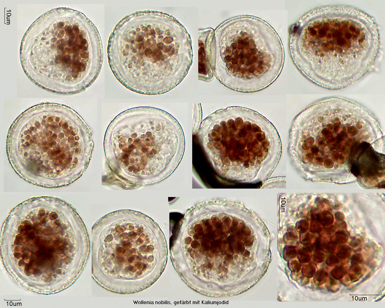 mit Kaliumjodid angefärbter Pollen von Wollemia nobilis, eingebettet in Glyceringelatine, A-030