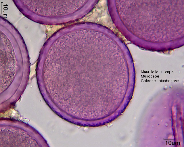 Pollen von Musella lasiocarpa