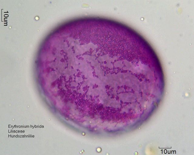 Pollen von Erythronium hybrida (1).jpg