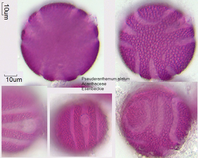 Pollen von Pseuderanthemum alatum
