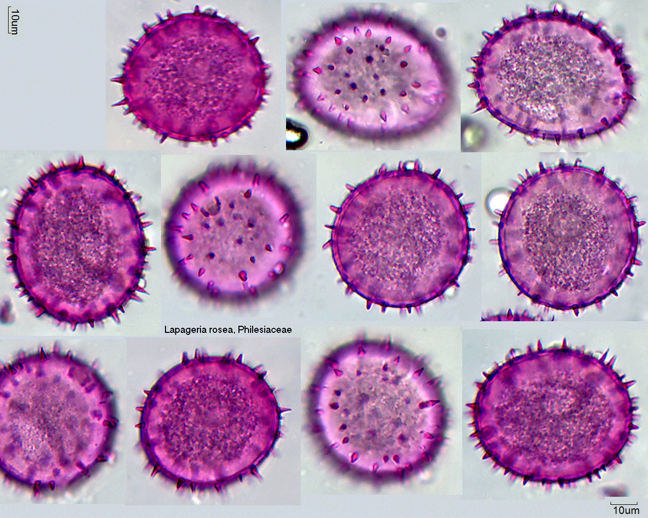 Pollen von Lapageria rosea