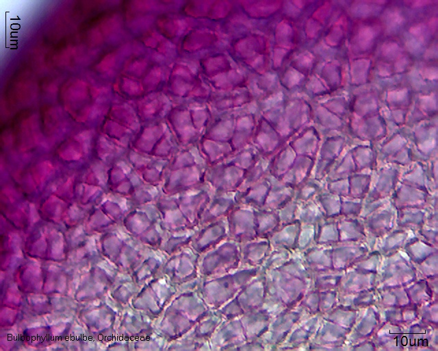 Pollinium mit PK von Bulbophyllum ebulbe