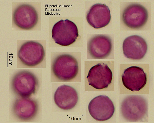 Pollen von Filipendula ulmaria, 1-078-1