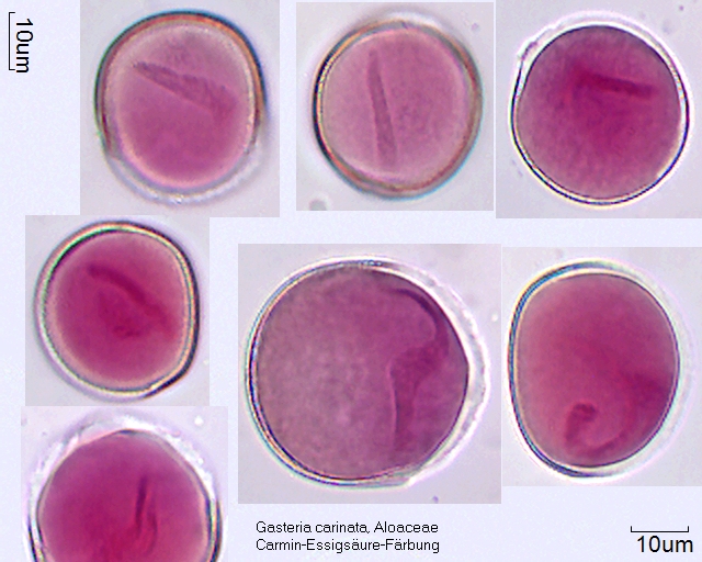Pollen von Gasteria carinata gefärbt mit Acetocarmin, A-023. Klar gefärbt ist der Kern der generativen Zelle. Die vegetative Zelle nimmt die Farbe nur schwach an.
