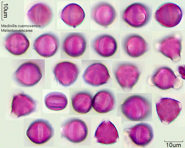 Pollen von Medinilla cuernosensis