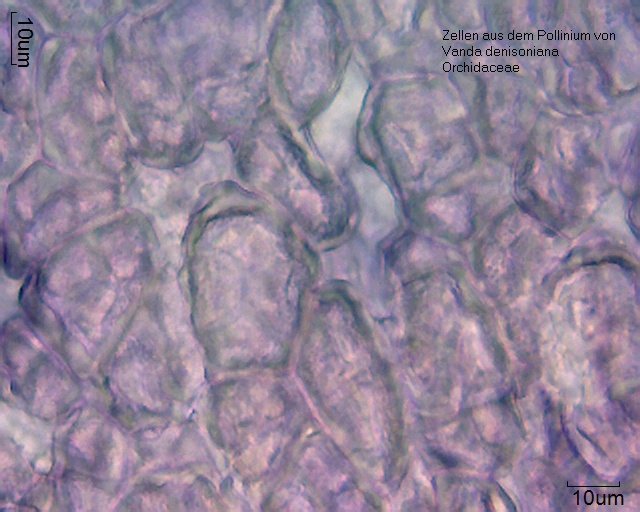 Zellen aus dem Pollinium von Vanda denisoniana