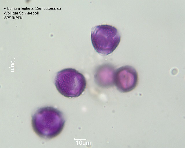Viburnum lantana (1).jpg