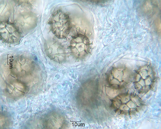 Tuber aestivum \u2013 Pollen-Wiki