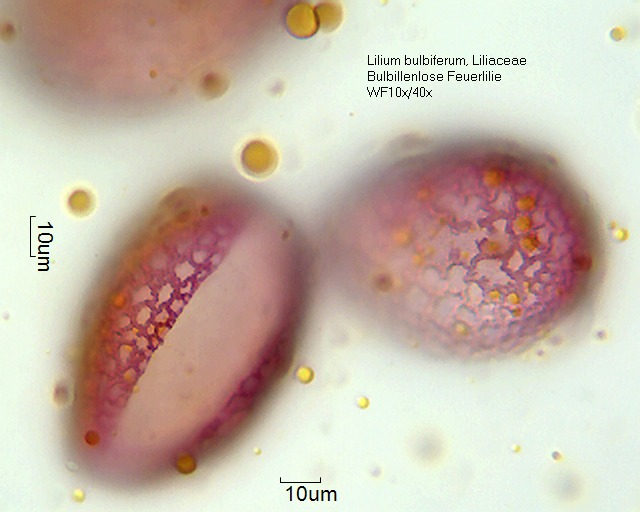 Pollen von Hemerocallis multiflora/1