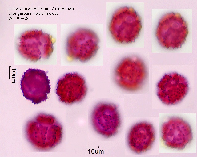 Pollen von Hieracium aurantiacum, 3-006