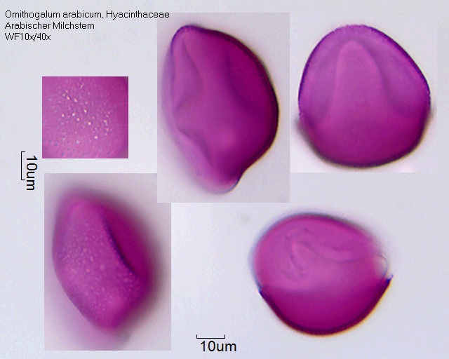 Pollen von Ornithogalum arabicum, 3-087