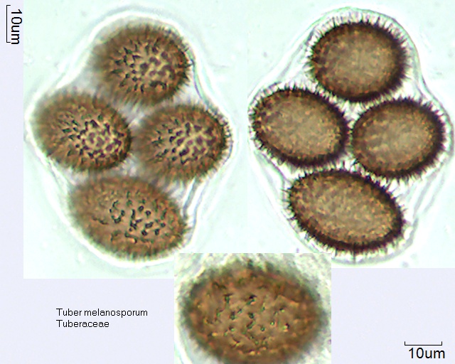 Sporen von Tuber melanosporum
