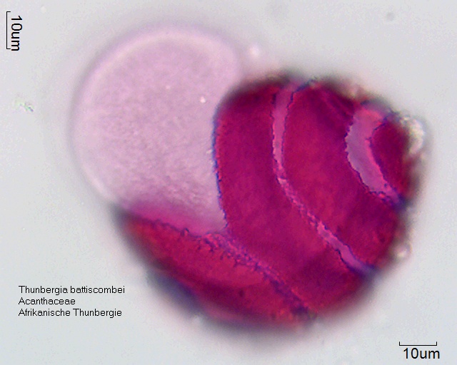 Datei:Thunbergia battiscombei (2).jpg