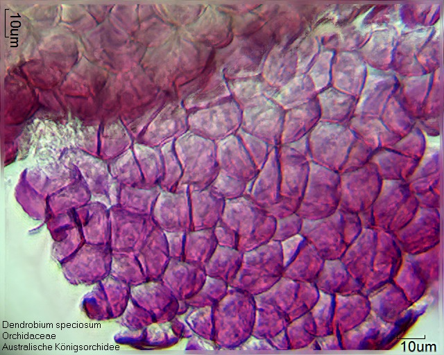 Zellen aus dem Pollinium von Dendrobium speciosum