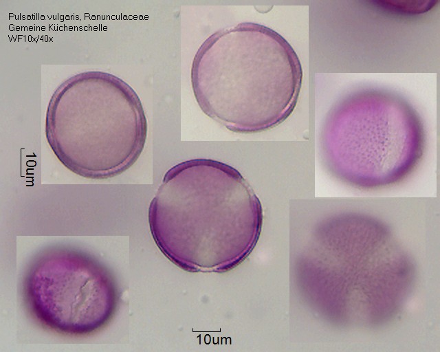 Pollen von Pulsatilla vulgaris