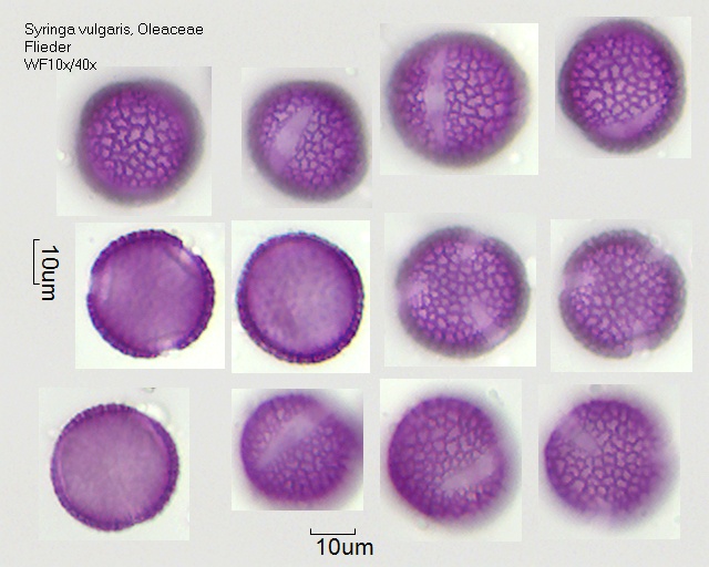 Pollen von Syringa vulgaris