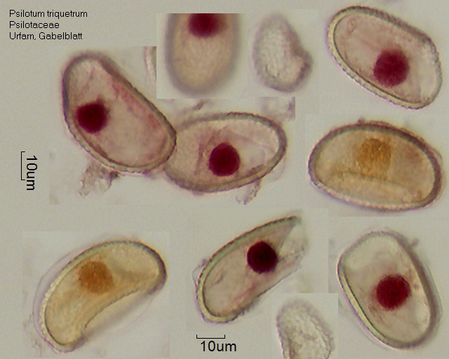 Sporen von Psilotum triquetrum