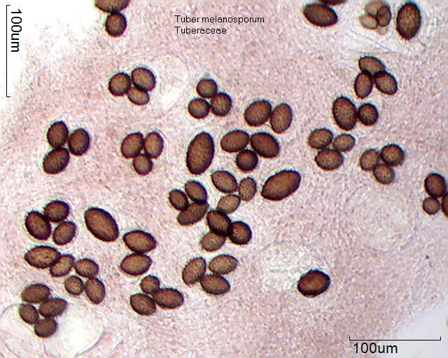 Sporen von Tuber melanosporum